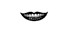 BRACES