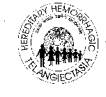 HEREDITARY HEMORRHAGIC TELANGIECTASIA OSLER WEBER RENDU SYNDROME