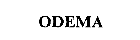 ODEMA