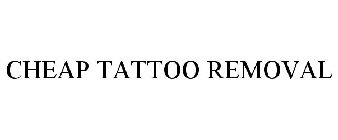 CHEAP TATTOO REMOVAL