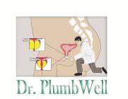 DR. PLUMBWELL ENLARGED PROSTATE NORMAL PROSTATE