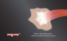 WONG WAY PHOTONS STRIKE INJURED CELLS TO STIMULATE BENEFICIAL CHEMICAL REACTIONS