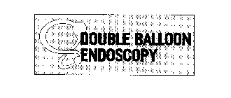 DOUBLE BALLOON ENDOSCOPY