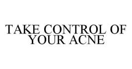 TAKE CONTROL OF YOUR ACNE