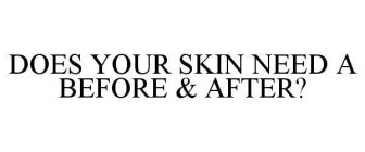 DOES YOUR SKIN NEED A BEFORE & AFTER?