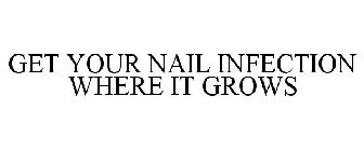 GET YOUR NAIL INFECTION WHERE IT GROWS
