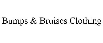 BUMPS & BRUISES CLOTHING