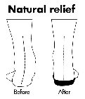 NATURAL RELIEF BEFORE AFTER