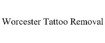 WORCESTER TATTOO REMOVAL