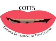 COTTS CHILDREN OF TETRACYCLINE TEETH STAINING