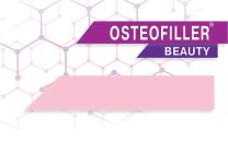 OSTEOFILLER BEAUTY