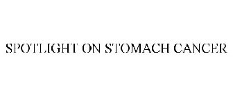 SPOTLIGHT ON STOMACH CANCER