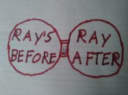 RAY'S RAY BEFORE & AFTER