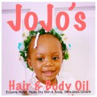 JOJO'S HAIR & BODY OIL ECZEMA RELIEF, HEALS DRY SKIN & SCALP, STIMULATES GROWTH