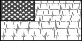 EKG