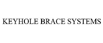KEYHOLE BRACE SYSTEMS