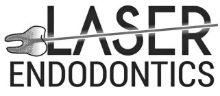 LASER ENDODONTICS