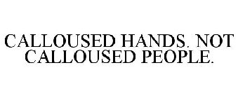 CALLOUSED HANDS. NOT CALLOUSED PEOPLE.