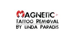 MAGNETIC TATTOO REMOVAL BY LINDA PARADIS 8 8 8 8