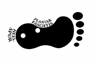 PLANTAR FASCIITIS HEEL SPUR