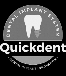 DENTAL IMPLANT SYSTEM - QUICKDENT - DENTAL IMPLANT INNOVATION